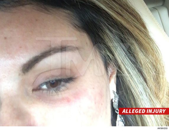 Liziane Gutierrez diz que Chris Brown deu um soco em seu olho. Foto: TMZ