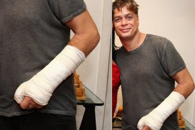 Fábio Assunção passa por nova cirurgia e ficará com gesso até o final de “Totalmente Demais”