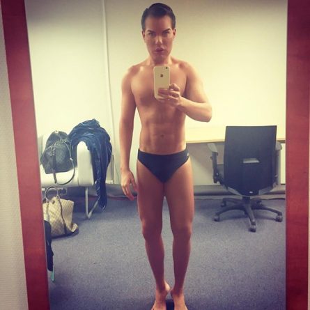 Após cirurgia, novo Ken Humano contrai bactéria comedora de carne