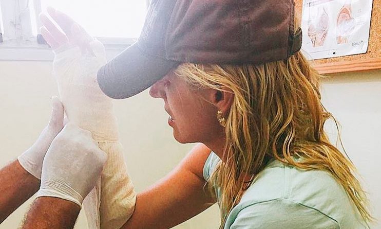 Val Marchiori sofre acidente e quase tem a mão amputada