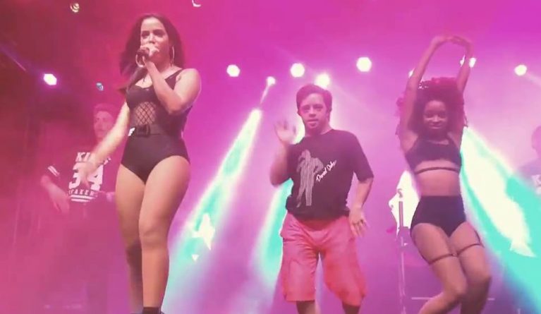 Anitta contrata bailarino com Síndrome de Down