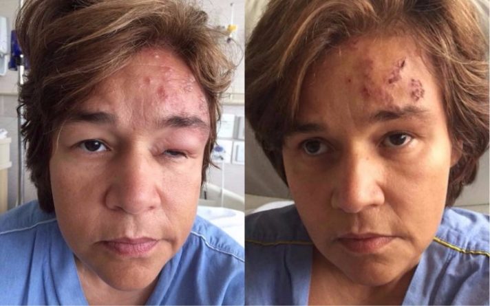 Claudia Rodrigues ganha alta de hospital