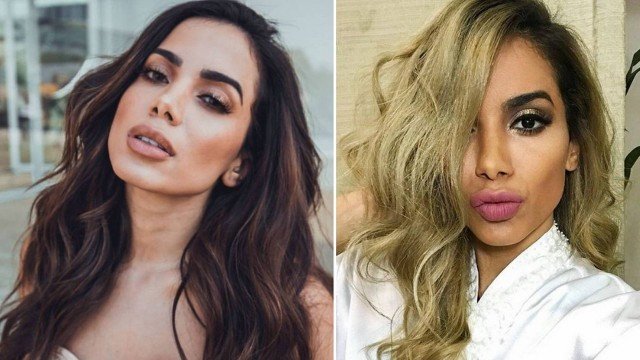 Anitta ficou loira por cachê milionário; saiba quanto