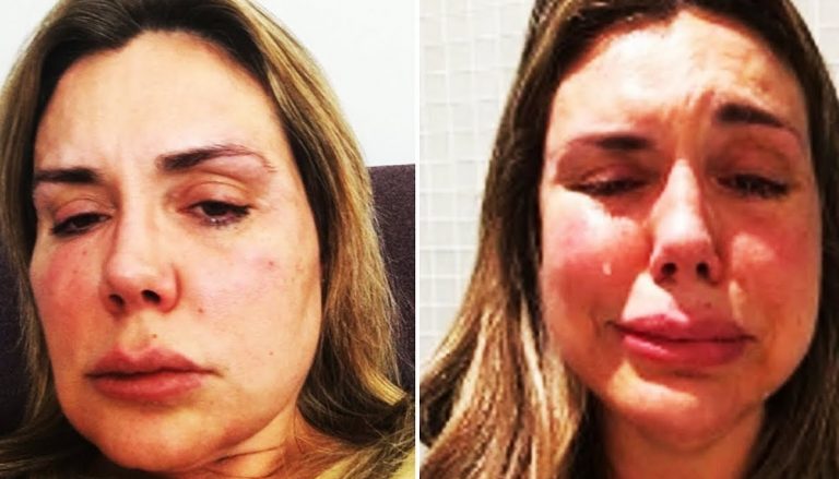 Renata Banhara é brutalmente espancada pelo marido
