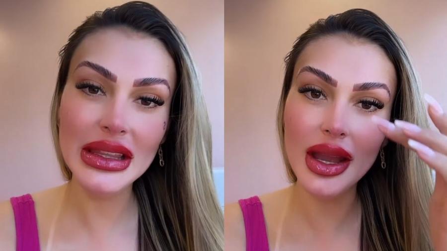 Andressa Urach faz procedimento nos lábios e resultado surpreende internautas