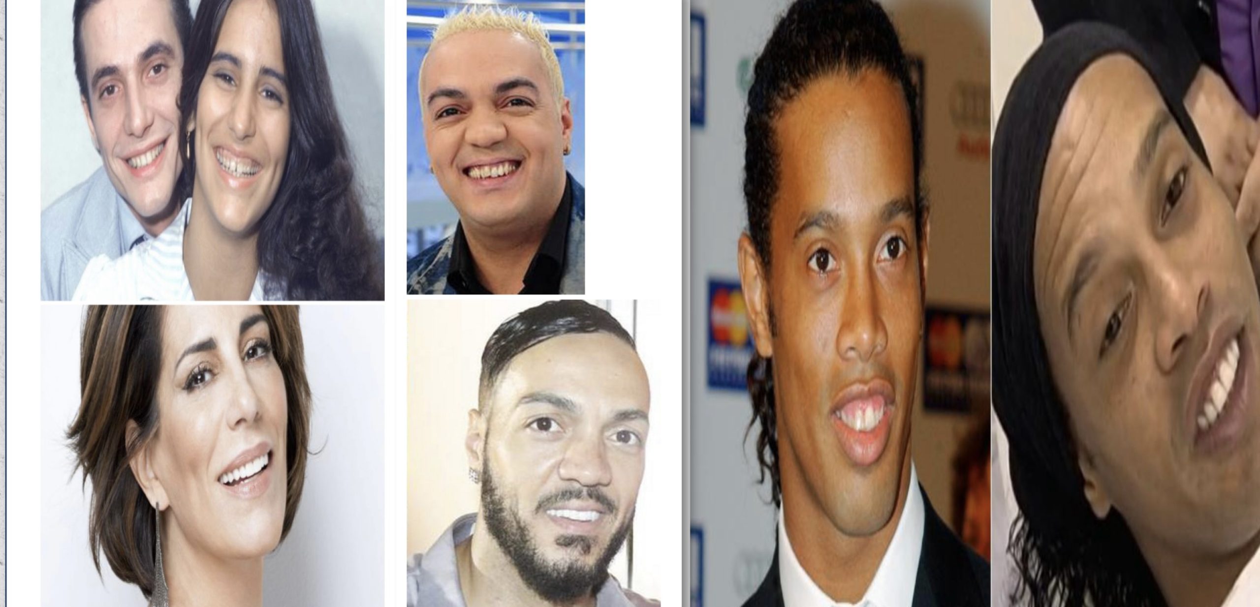 Especialista lista três celebridades que transformaram o sorriso