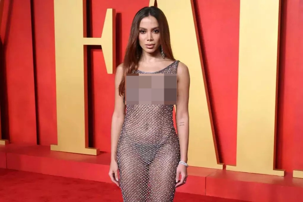 Anitta mostra seios em festa pós-Oscar e é criticada