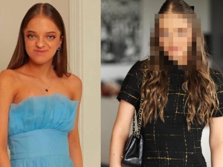 Rafaella Justus mostra resultado de cirurgia no rosto e mudança surpreende