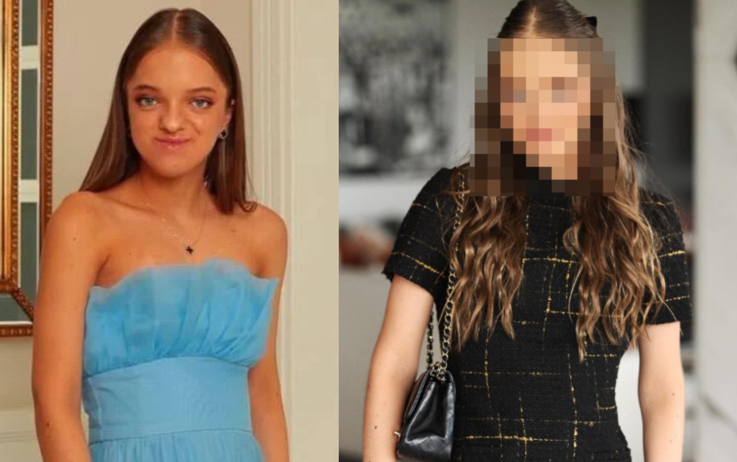 Rafaella Justus mostra resultado de cirurgia no rosto e mudança surpreende