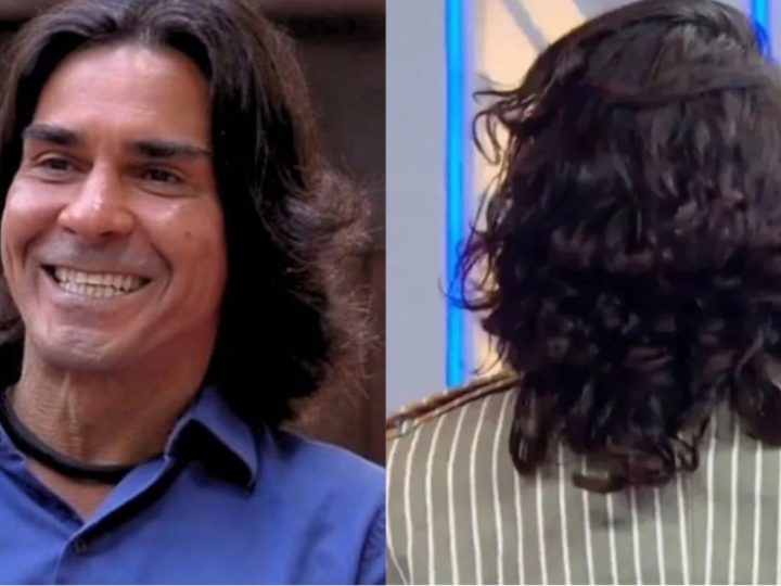 André Gonçalves faz harmonização facial e vira piada na internet