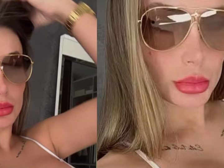 Andressa Urach mostra resultado de cirurgias e detalhe chama a atenção: “Ficou ridícula”