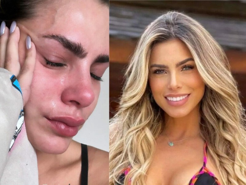 Erika Schneider sofre acidente em viagem e é hospitalizada