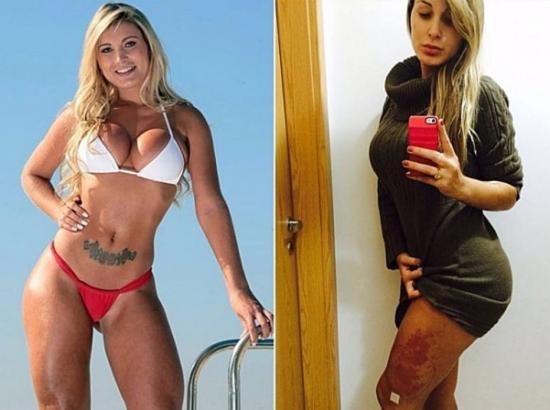 Com inflamação, Andressa Urach é internada novamente