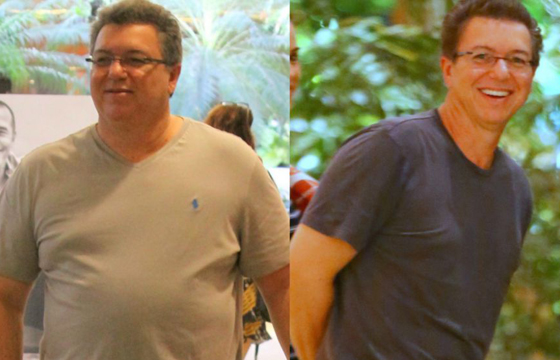 Boninho surge mais magro seis meses após redução de estômago; veja