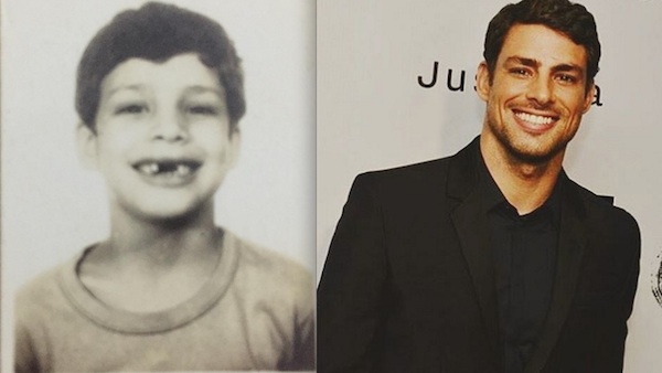 Cauã Reymond aparece ‘banguelo’ em foto; veja: