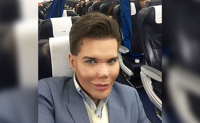 Ken Humano faz seguro do corpo após quase perder o nariz