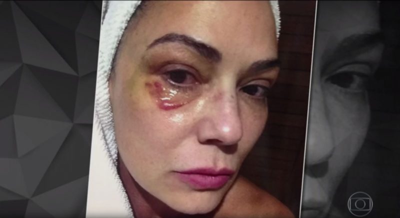 Luiza Brunet comemora decisão da justiça para ex-namorado que a agrediu