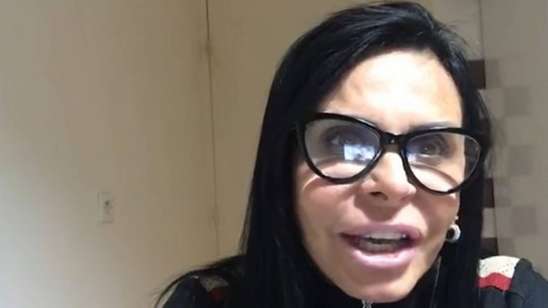 Gretchen mostra antes e depois de procedimentos estéticos e impressiona