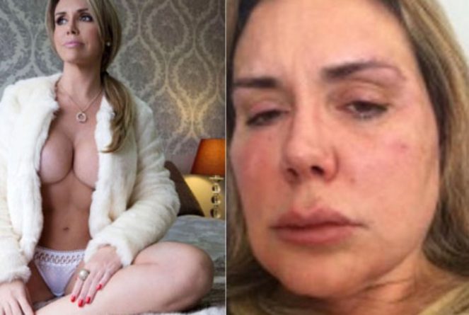 Renata Banhara afirma ter vontade de se matar