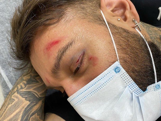 Lucas Lucco sofre acidente e vai parar no hospital