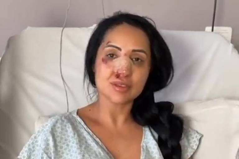 Após briga, irmã de Deolane aparece em hospital com o rosto machucado: “Nariz estraçalhado”