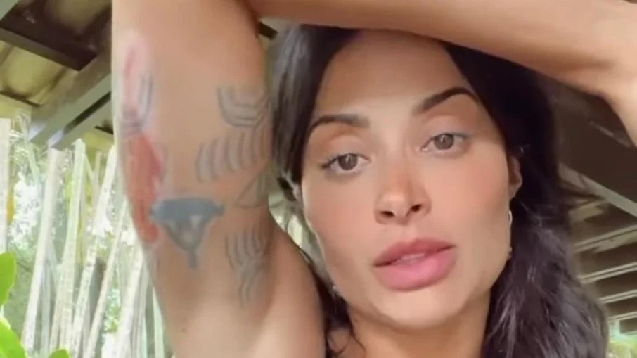 Aline Campos sofre acidente de moto e mostra os ferimentos: “Carne viva”