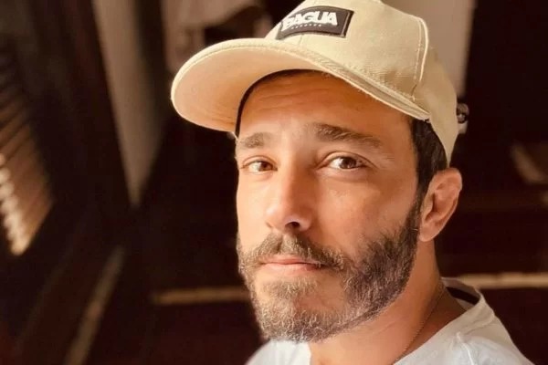 Ator é espancado por bandidos e perde parte do couro cabeludo; veja foto