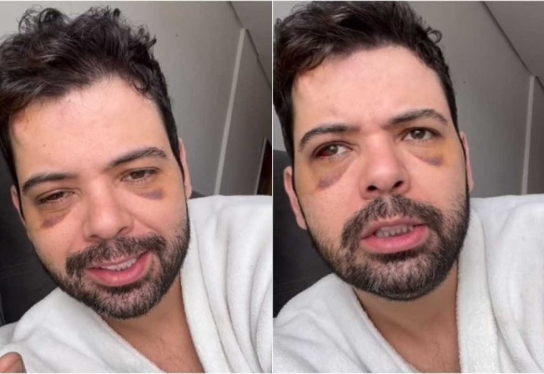 Humorista que imita Dilma Rousseff volta atrás em relato de agressão e dá nova versão
