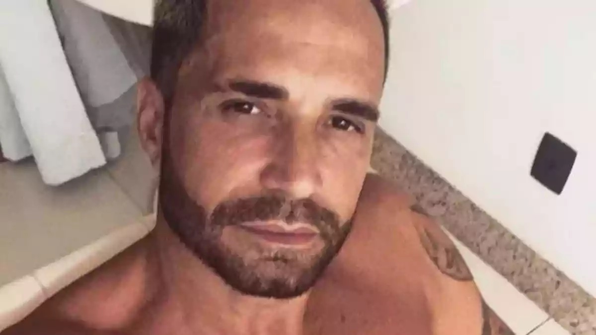 Latino faz rejuvenescimento facial e mostra resultado na internet