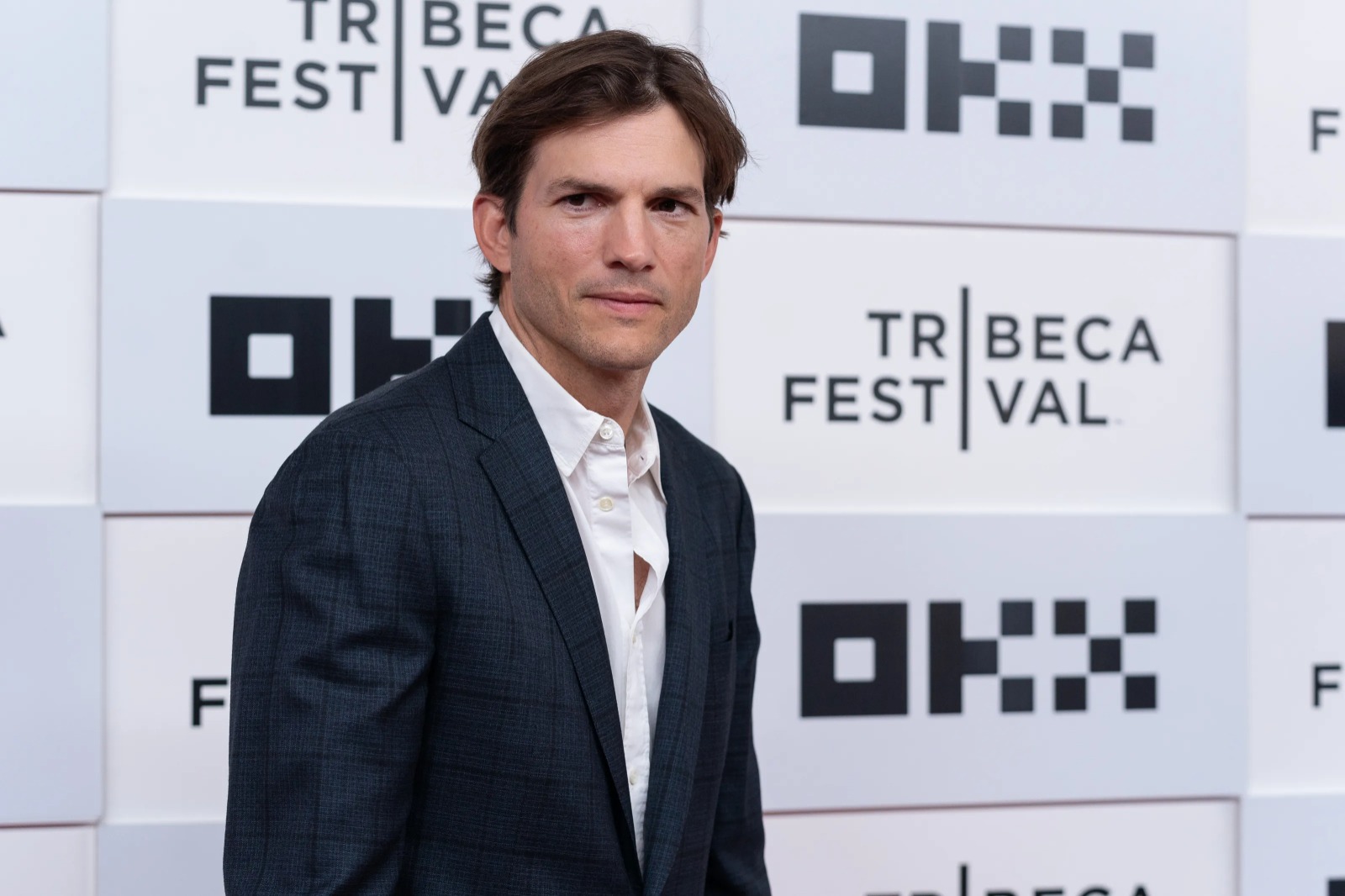 Ashton Kutcher revela susto com bala de maconha após cirurgia