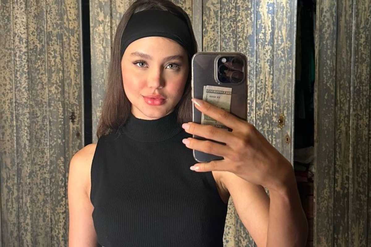 Esposa de Sorocaba faz cirurgia para diminuir tamanho da testa