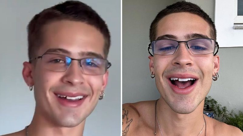João Guilherme sofre acidente e perde parte do dente; confira