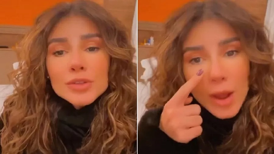Paula Fernandes surge irreconhecível e internautas apontam procedimento: “Que rosto é esse?”