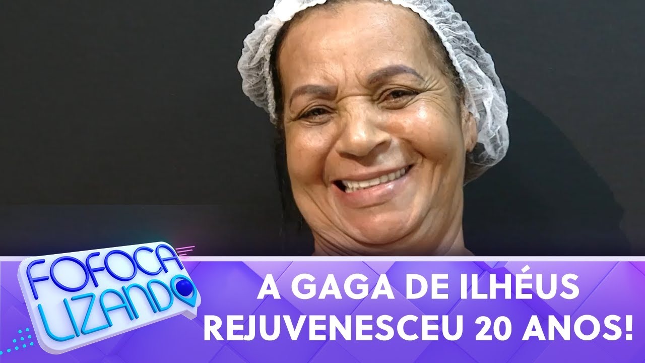 Aos 70 anos, Gaga de Ilhéus faz harmonização facial e resultado impressiona: “Melhorou 10000%”