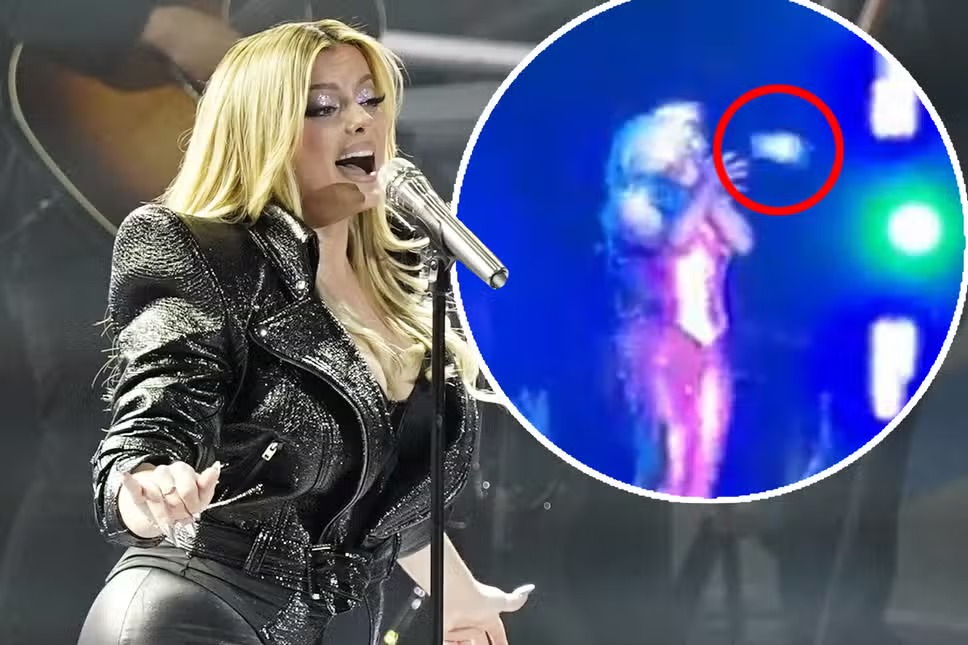 Cantora americana mostra hematoma no rosto após ser atingida por celular em show
