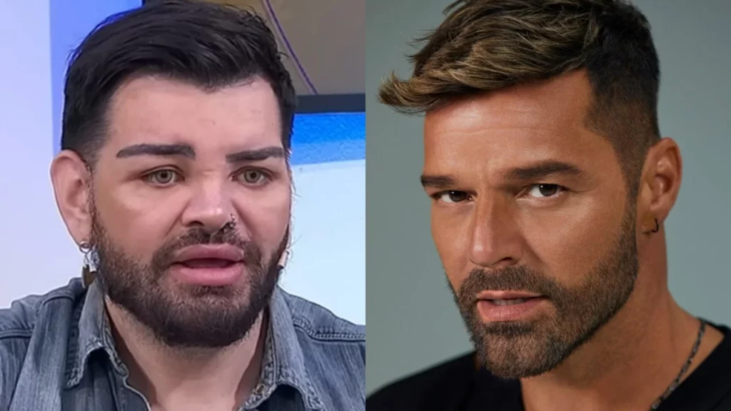 Argentino realiza mais de 30 cirurgias para se parecer com Ricky Martin