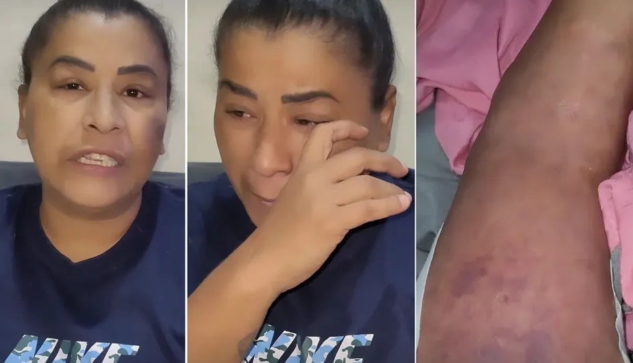 MC Katia pede ajuda na internet e revela graves problemas de saúde