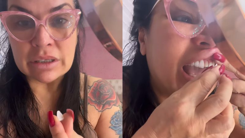 Solange Gomes conserta dente com super cola e é criticada: “Como alguém tem coragem?”