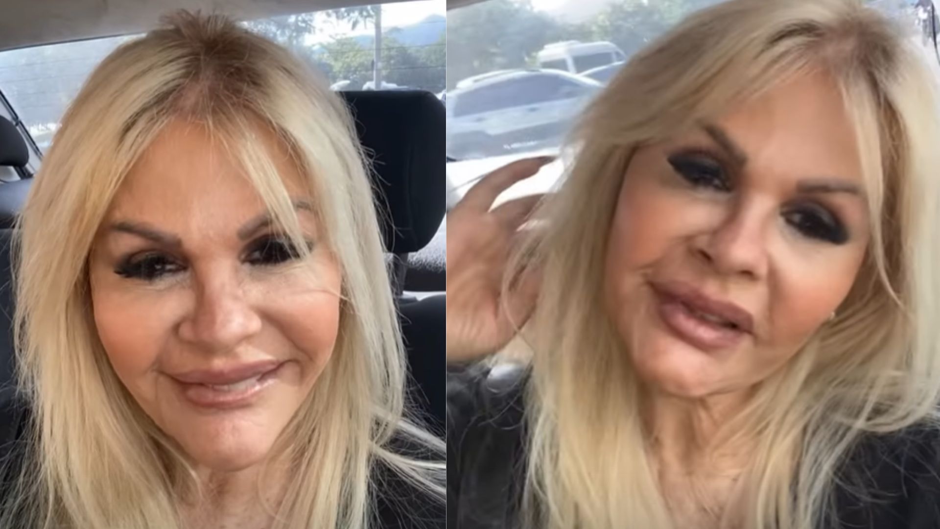Monique Evans faz harmonização facial; veja o antes e depois