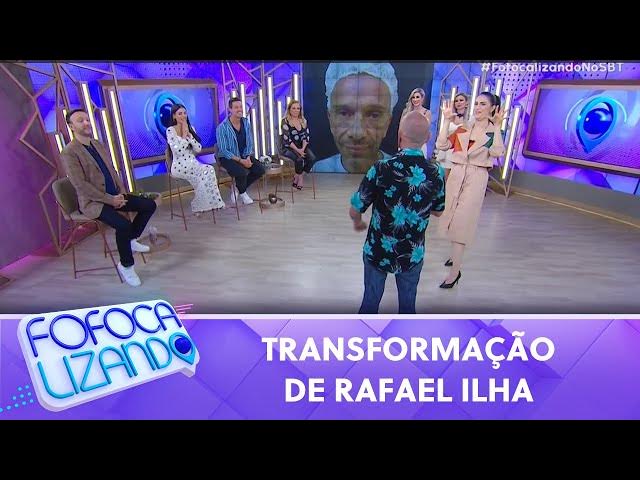 Rafael Ilha faz harmonização, mostra resultado no SBT e choca o público