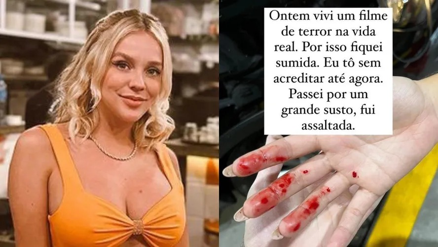 Atriz de Malhação é assaltada e hospitalizada após ferimentos