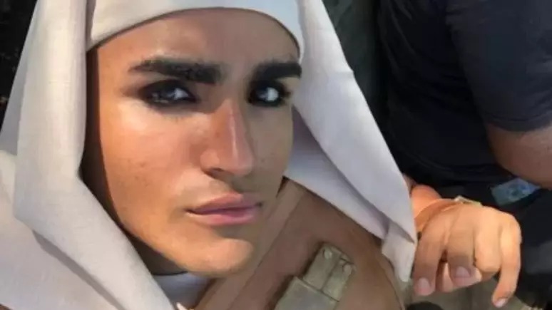 Figurante da Record revela que pegou sarna por descaso da emissora: “Meu corpo todo”