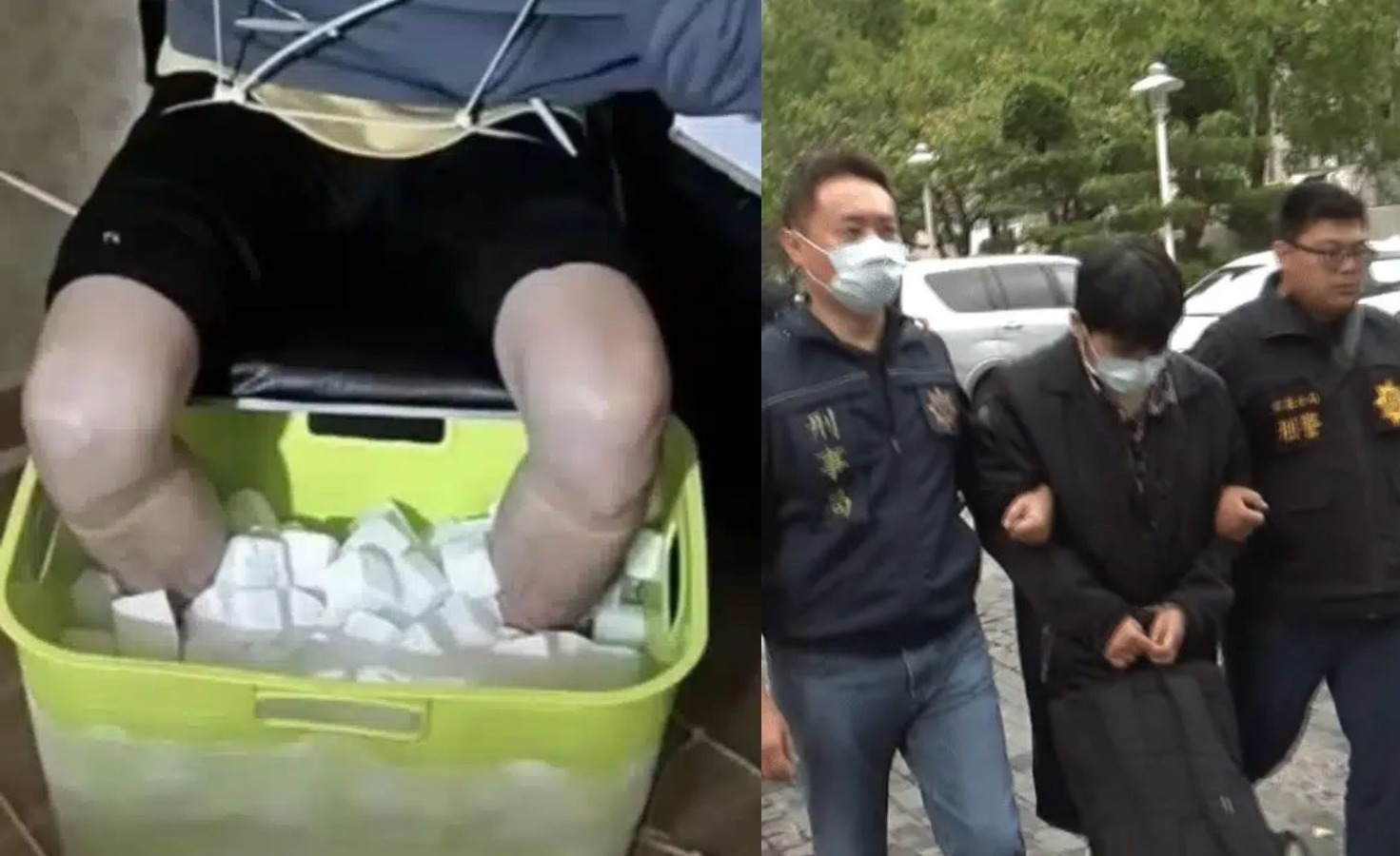 Homem amputa as próprias pernas para receber indenização milionária e é preso