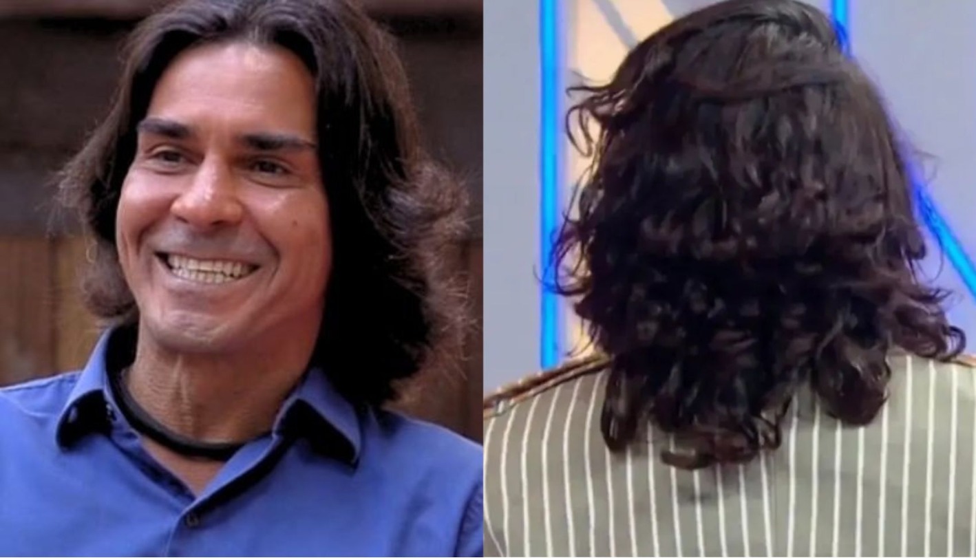André Gonçalves faz harmonização facial e vira piada na internet