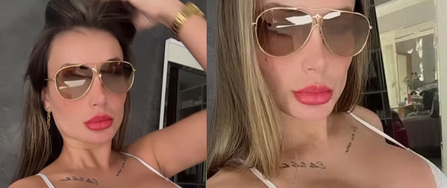 Andressa Urach mostra resultado de cirurgias e detalhe chama a atenção: “Ficou ridícula”