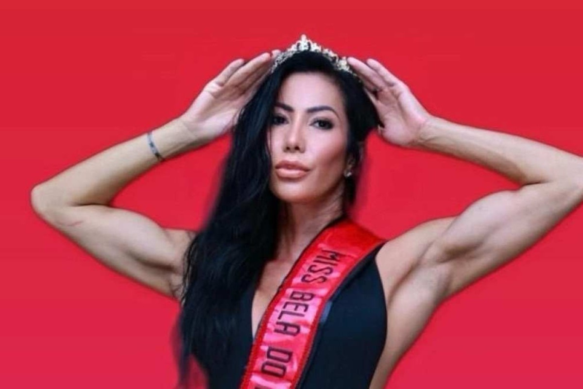 Michele Umezu, ex de Ronaldo, adere ao “chip da beleza” e fala sobre procedimento inovador