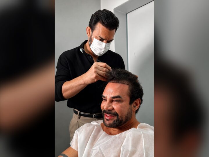 Felipe Duram escolhe o Dr. Pablo Milhomem para novo transplante capilar