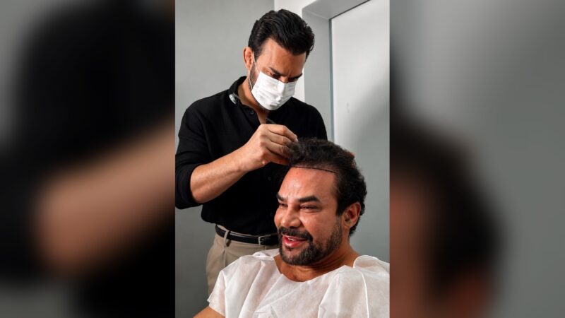 Felipe Duram escolhe o Dr. Pablo Milhomem para novo transplante capilar