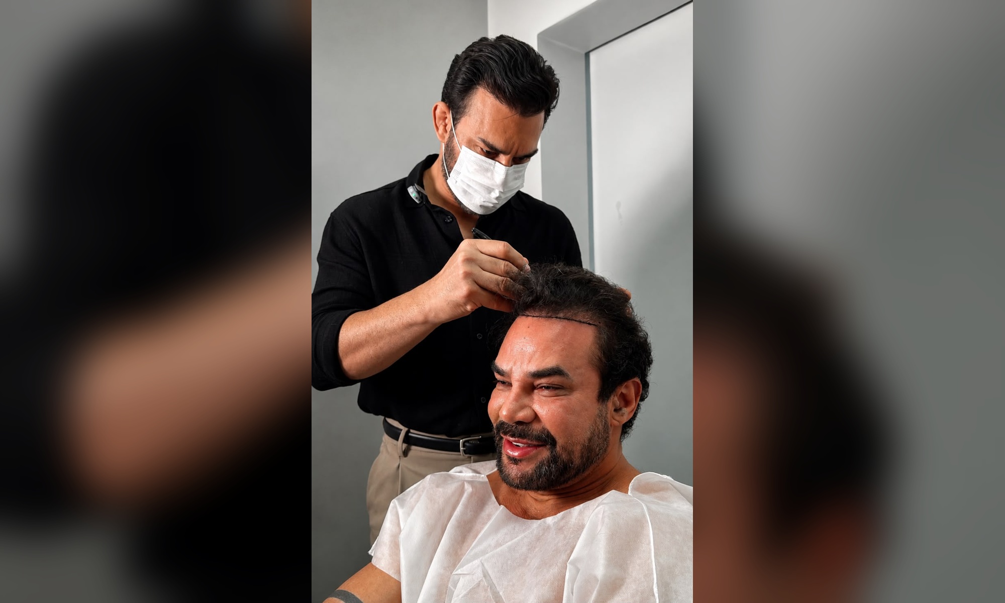 Felipe Duram escolhe o Dr. Pablo Milhomem para novo transplante capilar